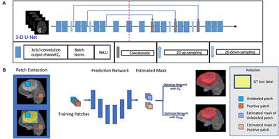 3D-BoxSup: Positive-Unlabeled Learning of Brain Tumor Segmentation Networks From 3D Bounding Boxes